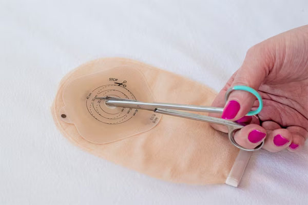 Buy Colostomy Bags Online at Lowest Prices